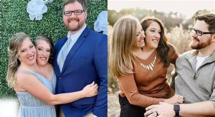 The Hensel Twins: Brittany And Ashley's Journey