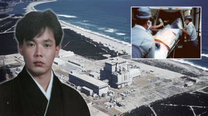 The Hisashi Ouchi Body: An Incredible Tale Of Survival And Resilience