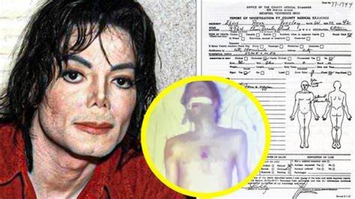 The Mysterious Truth: Michael Jackson's Autopsy Report Revealed