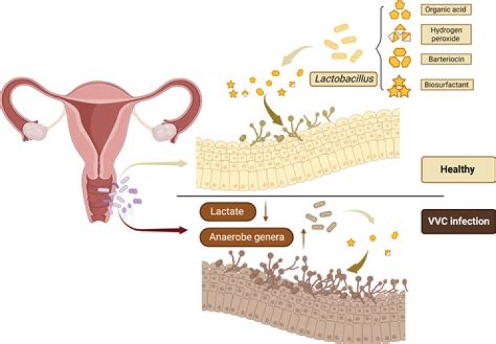 The Rise Of A Vaginal Health Advocate