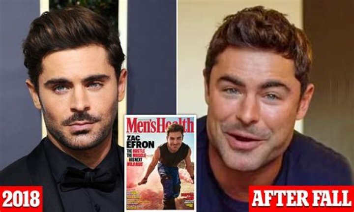 The Shocking Story Of Zac Efron's Devastating Accident: Details And Aftermath