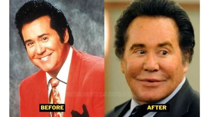 The Surprising Illness Impacting Wayne Newton's Health