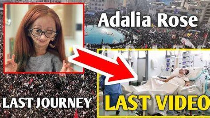 The Tragic End Of Adalia Rose: Uncovering The Date Of Her Passing