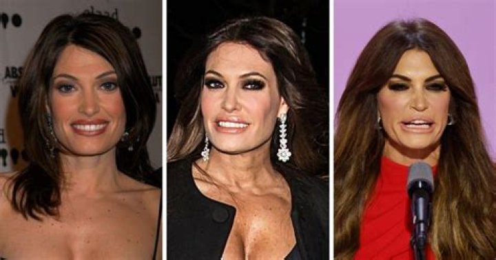 The Transformation Of Kimberly Guilfoyle's Face: What Procedures Has She Had?