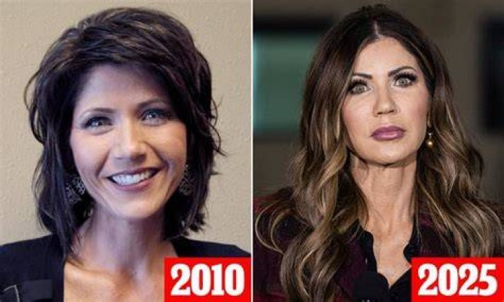 The Transformation Of Kristi Noem: Before And After