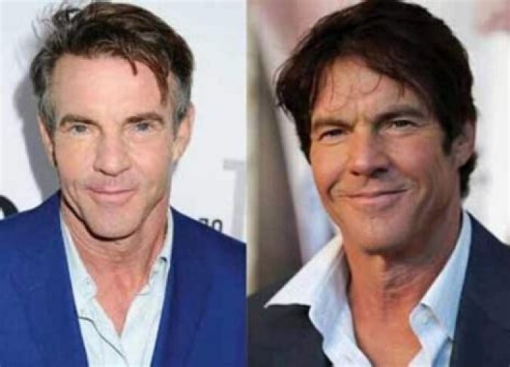 The Truth About Dennis Quaid's Plastic Surgery Rumors