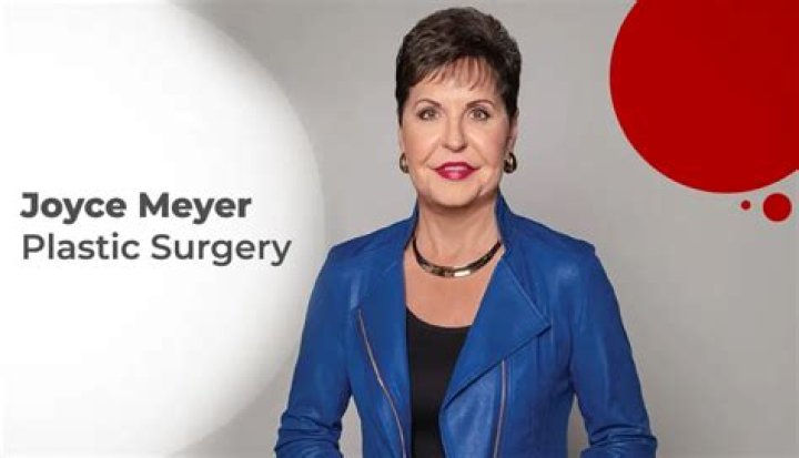 The Truth About Joyce Meyer's Plastic Surgery