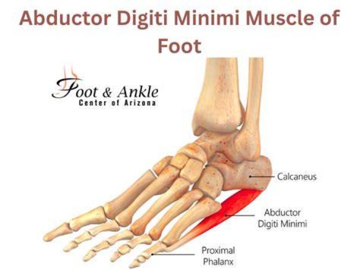 The Ultimate Guide To Abductor Digiti Minimi Foot Pain: Causes, Treatments, And Prevention