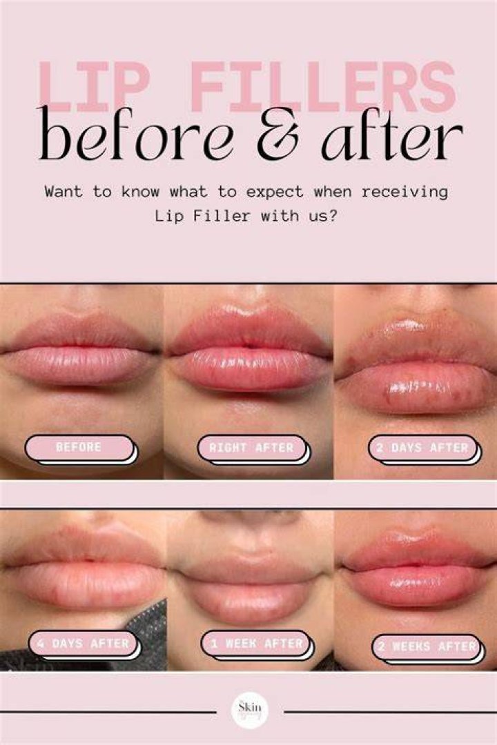 The Ultimate Guide To Ellen Pompeo's Lip Filler Journey