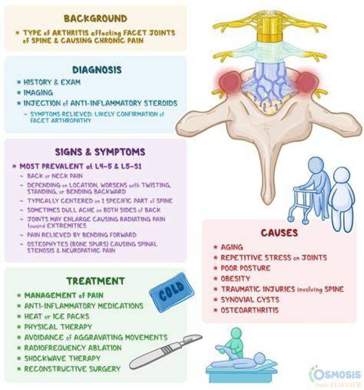 The Ultimate Guide To Facet Hypertrophy: Causes, Symptoms, And Treatments