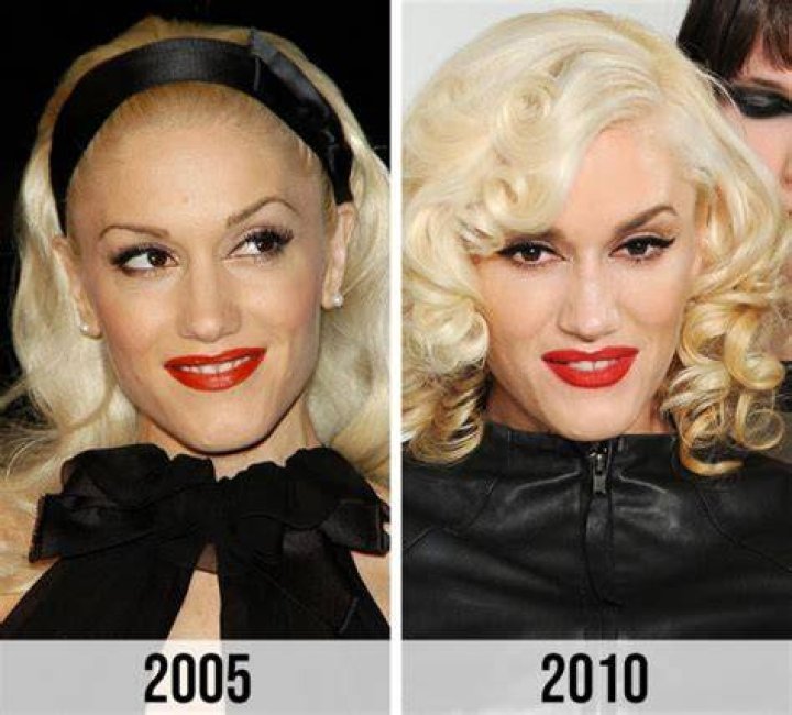 The Ultimate Guide To Gwen Stefani's Iconic Lips: Surgery Secrets Revealed