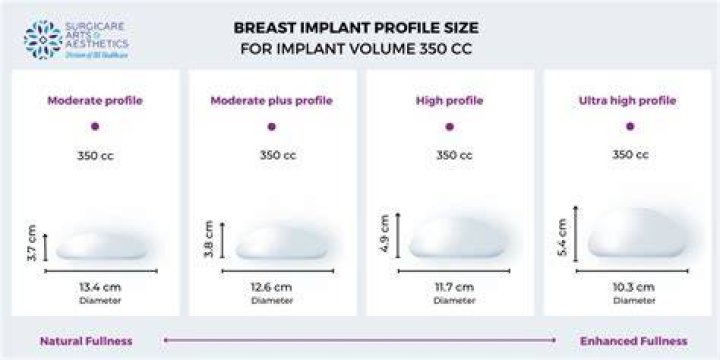 The Ultimate Guide To Kristen Doute's Breast Implants: Sizes, Costs, And Recovery