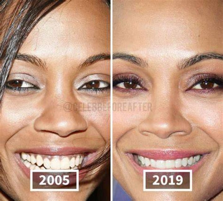 The Ultimate Guide To Zoe Saldana's Nose Job: Transformation And Controversy