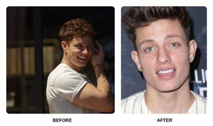 The Unseen Truth About Matt Rife's Dental Woes