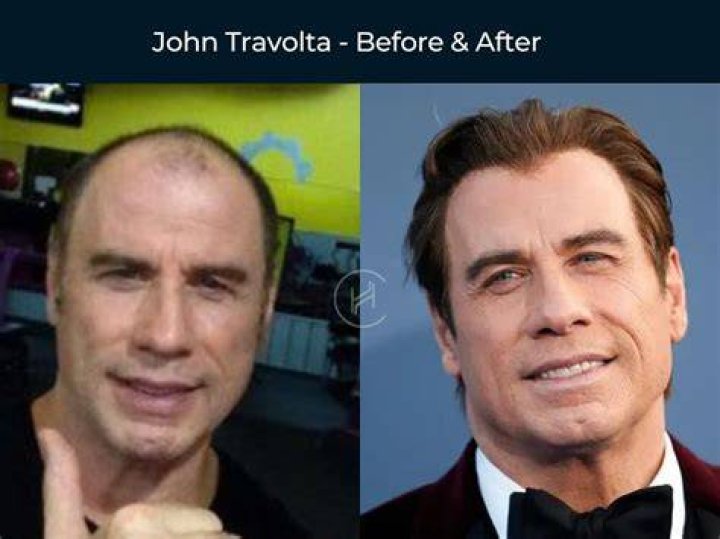 The Weighty Journey Of John Travolta