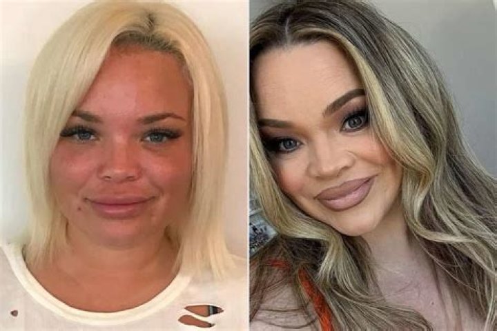 Trisha Paytas' Body: A Transformation Journey