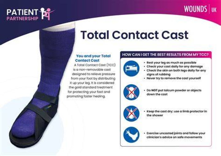 Ultimate Guide To Full Body Casts For Women: Comprehensive Guide