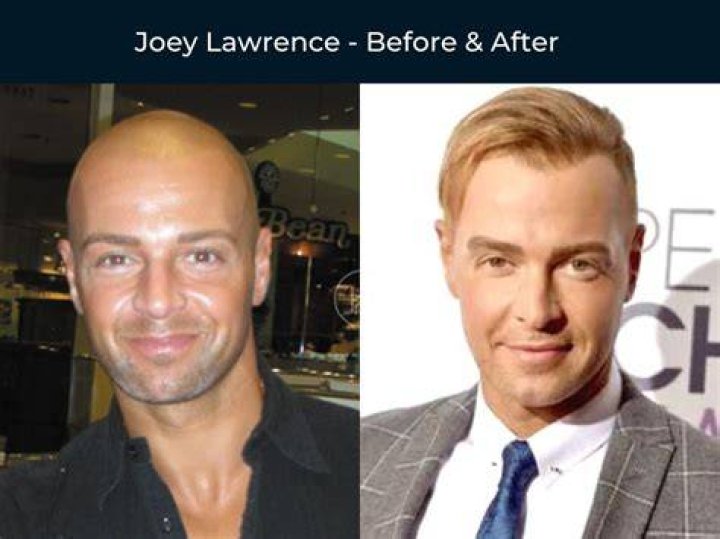 Unbelievable Joey Lawrence Eyebrow Transformation: Before And After