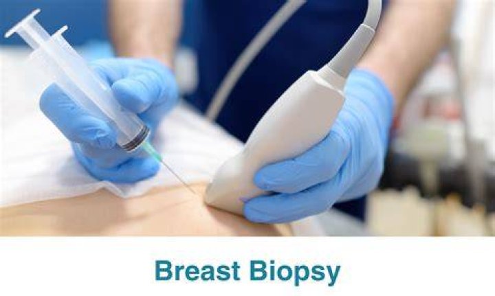 Uncover The Cost Of Breast Biopsy: A Financial Guide