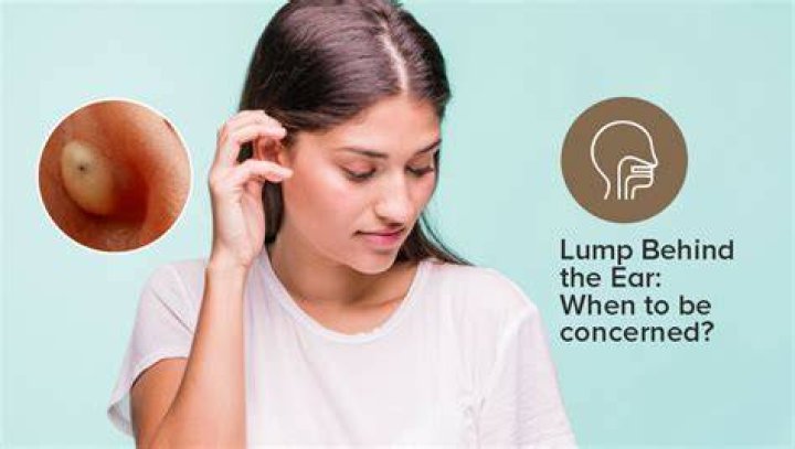 Uncovering The Mystery Behind His Ear Lump