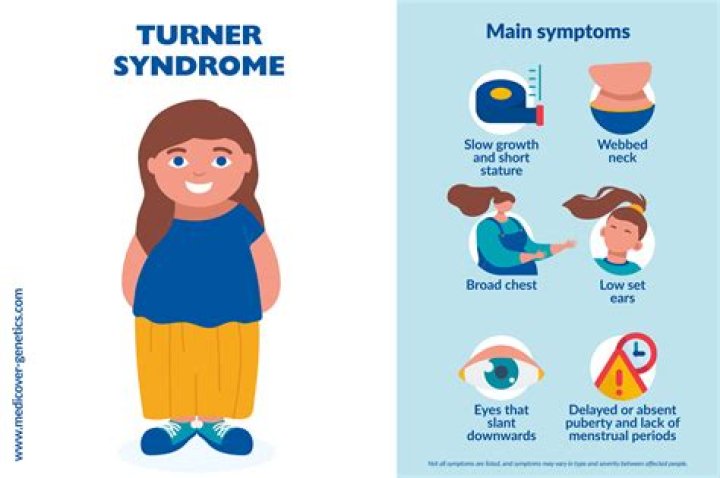 Uncovering The Stories Of Famous Women With Turner Syndrome
