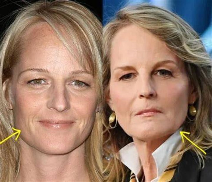 Uncovering The Truth: Helen Hunt's Journey To Motherhood
