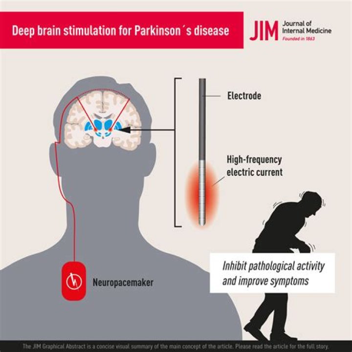 Understanding Chris Isaak's Battle With Parkinson's Disease