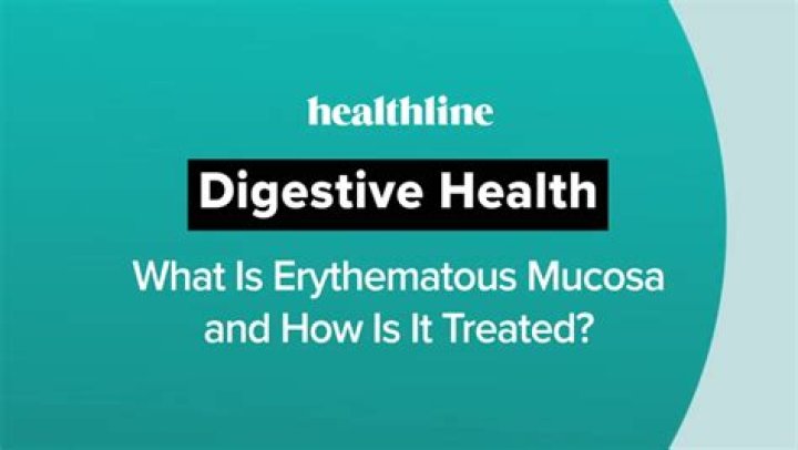 Understanding Erythematous Mucosa: Causes, Symptoms, And Treatment