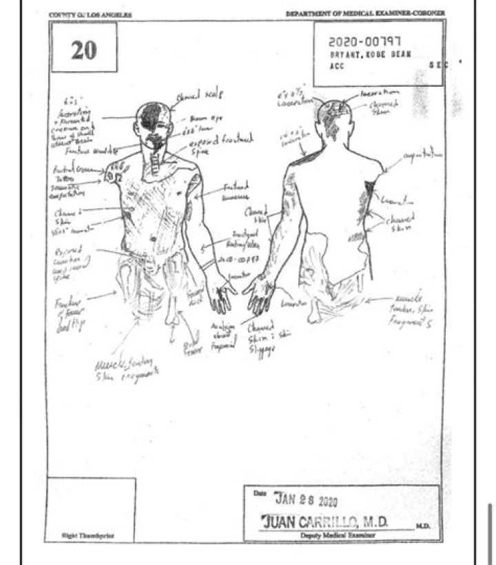 Unraveling The Gianna Bryant Autopsy: Uncovering The Truth
