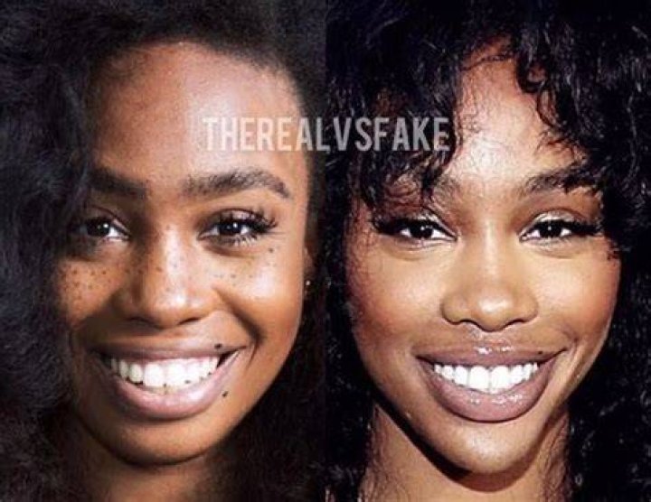 Unveiling SZA's Natural Beauty: No Plastic Surgery Secrets Revealed