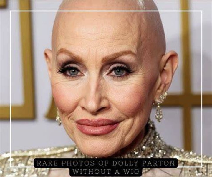 Unveiling The "Dolly Without Wig" Aesthetic: Discoveries And Insights