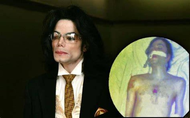 Unveiling The Secrets Of Michael Jackson's Autopsy Report
