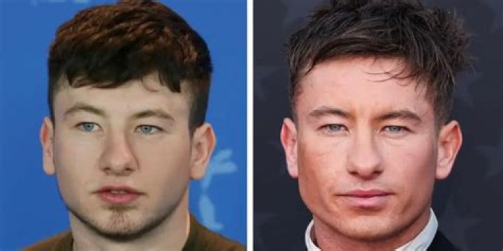 Unveiling The Truth Behind Barry Keoghan's Face Surgery: A Deep Dive