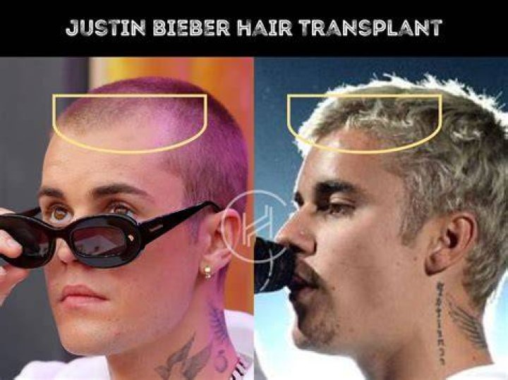 Unveiling The Truth Behind The "dod Justin Bieber Die" Hoax: Discoveries And Insights