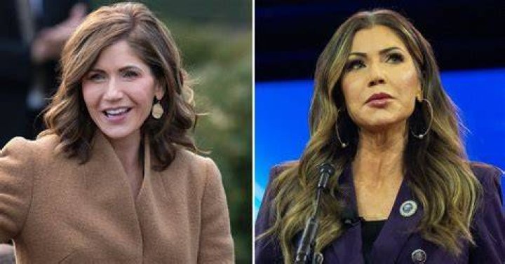 Unveiling The Truth: Discoveries In Kristi Noem's Plastic Surgery Journey