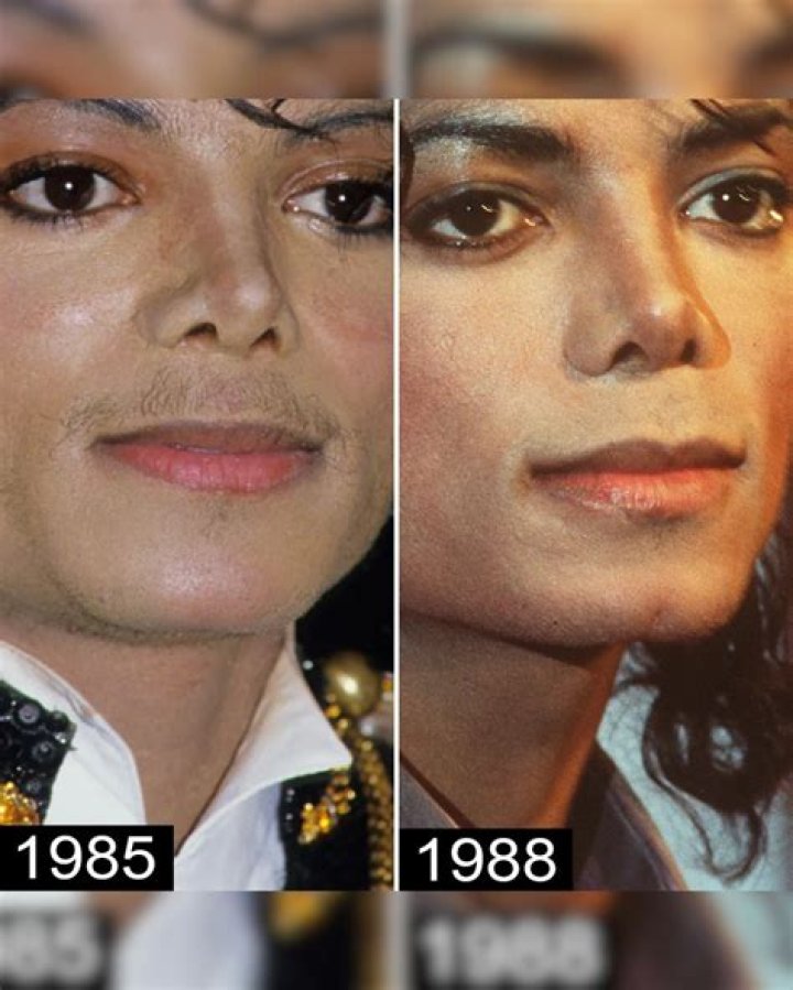 Unveiling The Truth: Michael Jackson Autopsy Photos