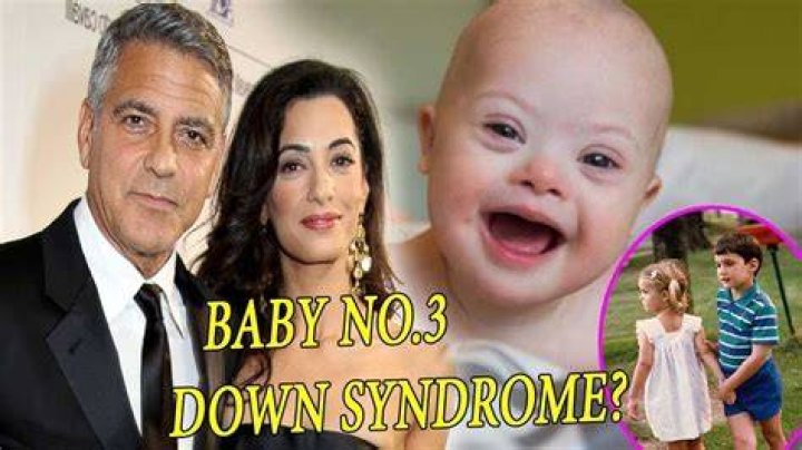 Unveiling The Truths Behind George Clooney's Twins And Down Syndrome