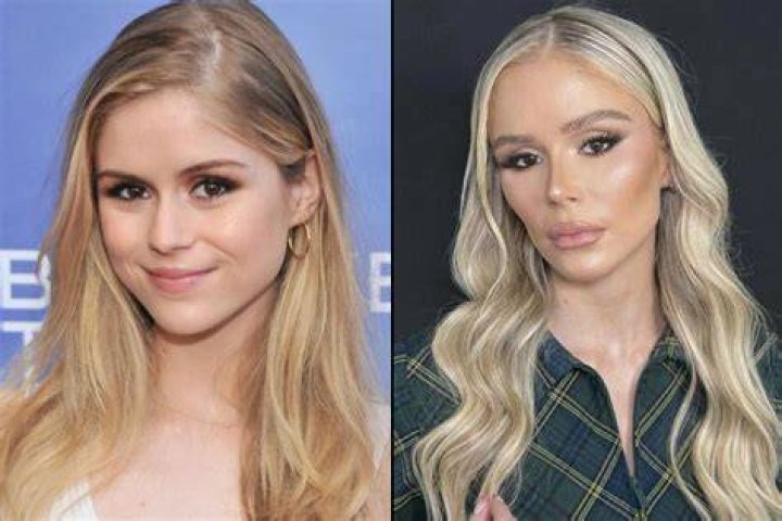 Unveiling Tomi Lahren's Plastic Surgery: Surprising Revelations