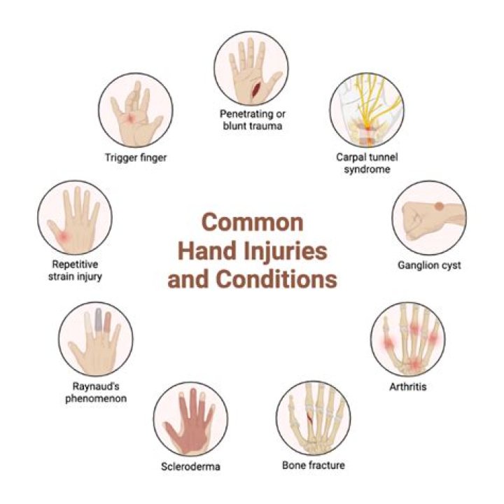 Visual Guide To Broken Hand Injuries