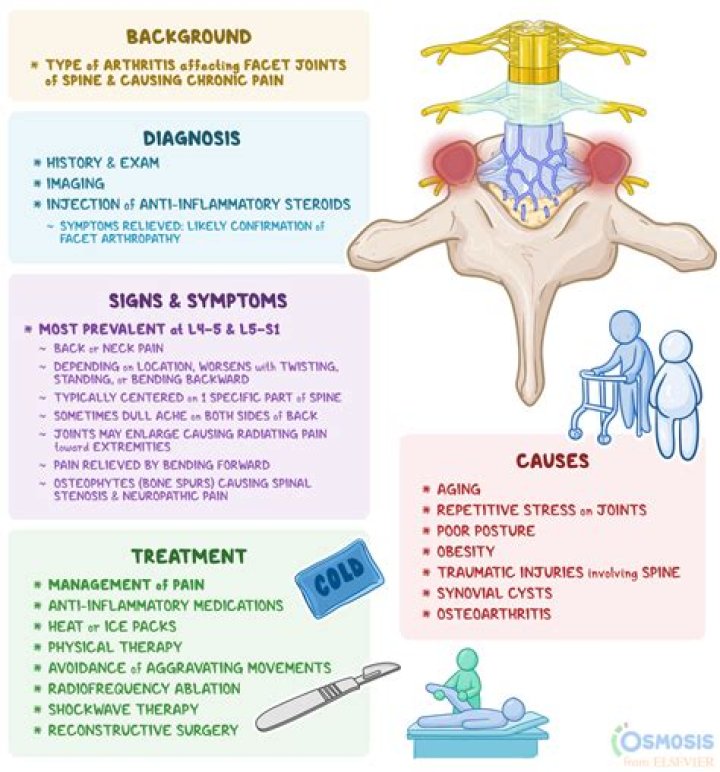 What Is Facet Arthropathy? A Comprehensive Guide To Its Meaning