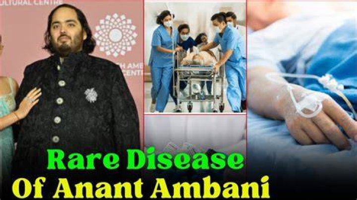 Which Disease Has Anant Ambani? Unraveling The Truth