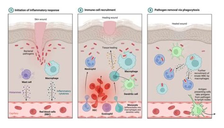 Which Group Of Mediators Triggers The Inflammatory Response? A Guide