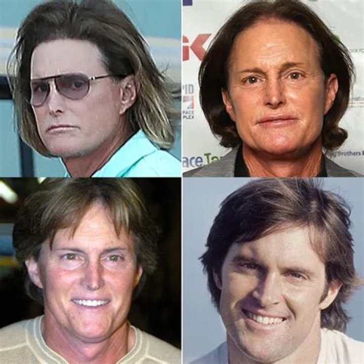 Why Caitlyn Jenner's Transgender Journey Matters